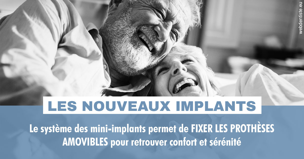 https://dr-curnier-laure.chirurgiens-dentistes.fr/Les nouveaux implants 2