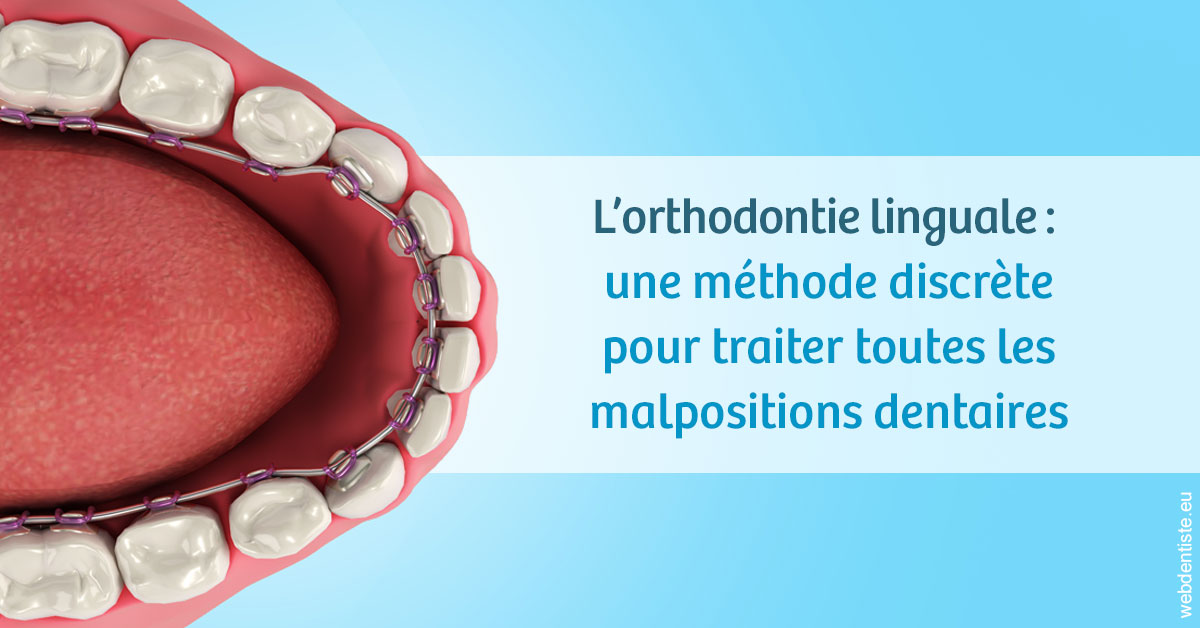 https://dr-curnier-laure.chirurgiens-dentistes.fr/L'orthodontie linguale 1