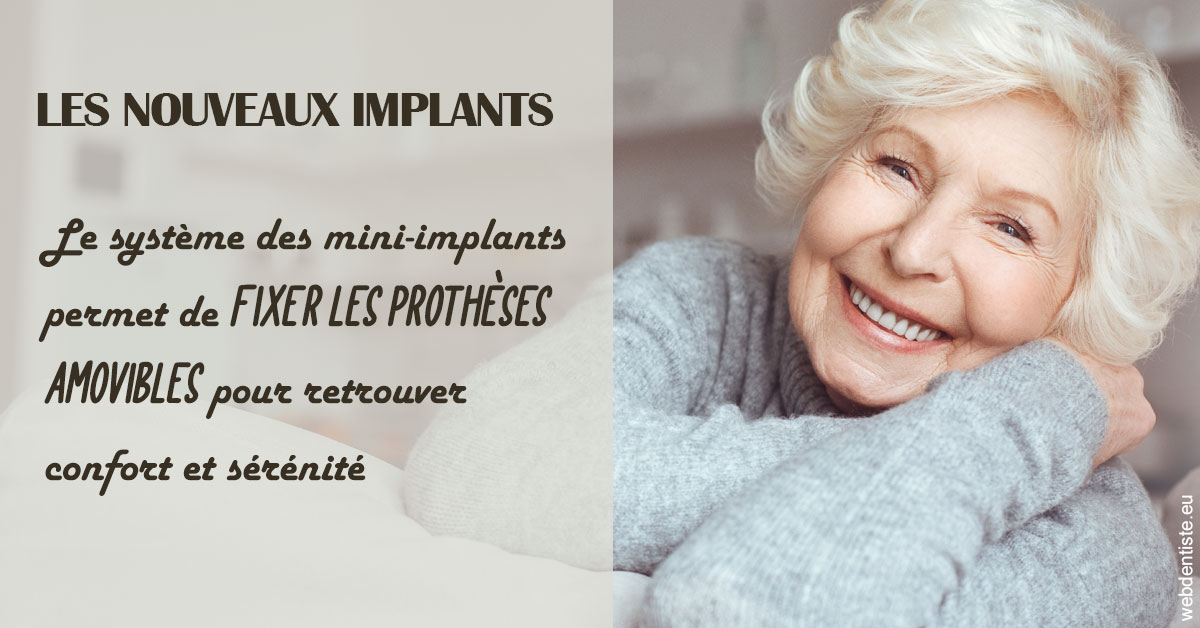 https://dr-curnier-laure.chirurgiens-dentistes.fr/Les nouveaux implants 1