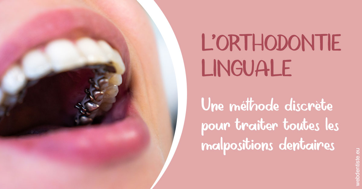 https://dr-curnier-laure.chirurgiens-dentistes.fr/L'orthodontie linguale 2