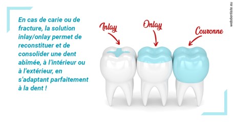 https://dr-curnier-laure.chirurgiens-dentistes.fr/L'INLAY ou l'ONLAY
