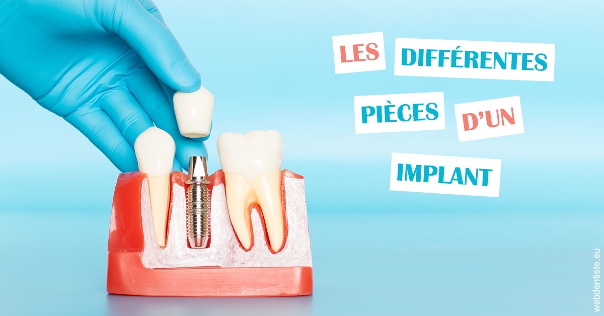 https://dr-curnier-laure.chirurgiens-dentistes.fr/Les différentes pièces d’un implant 2