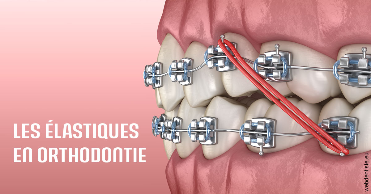 https://dr-curnier-laure.chirurgiens-dentistes.fr/Elastiques orthodontie 2