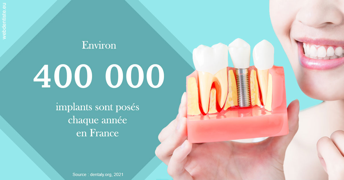 https://dr-curnier-laure.chirurgiens-dentistes.fr/Pose d'implants en France 2